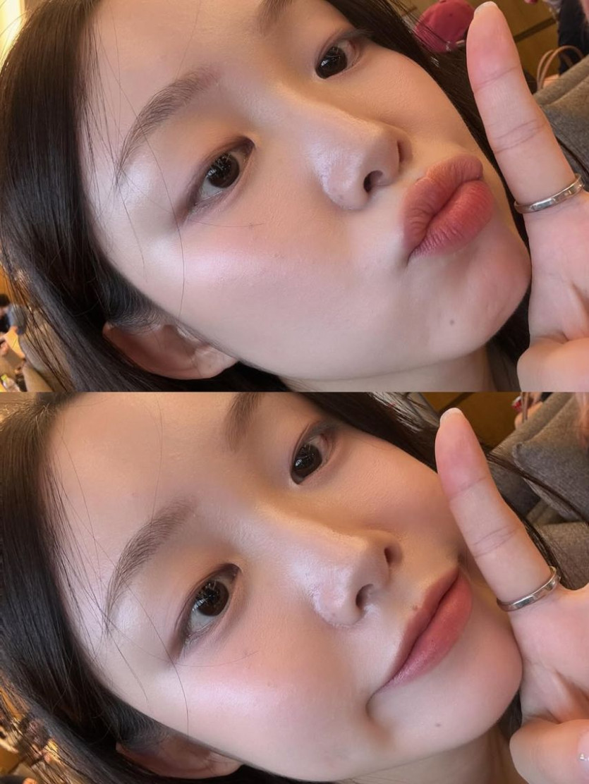 본문 이미지