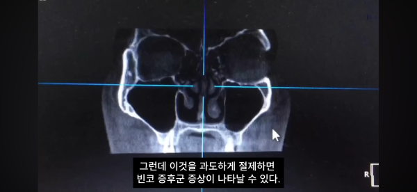 df0d65524ede17b54aa669b6a92633dd_1791159006_2187.png